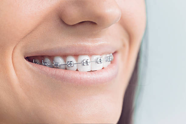 Dental Inlays and Onlays in Maplewood, WA
